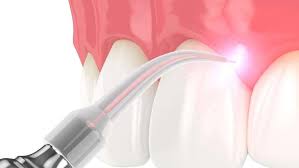 Preventive Dentistry